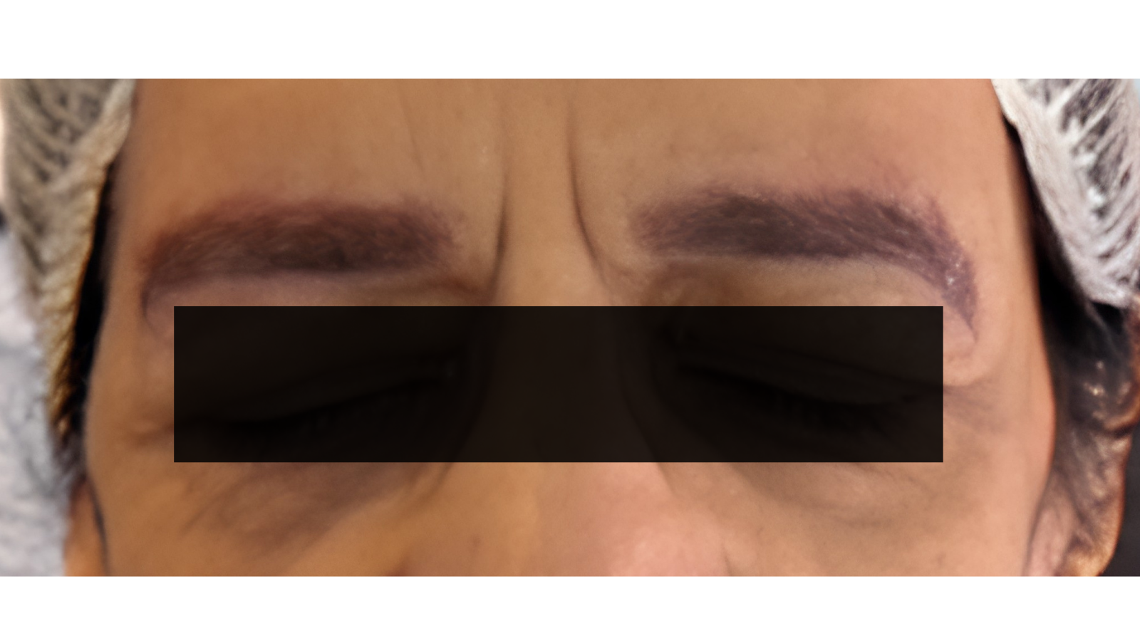 Other after