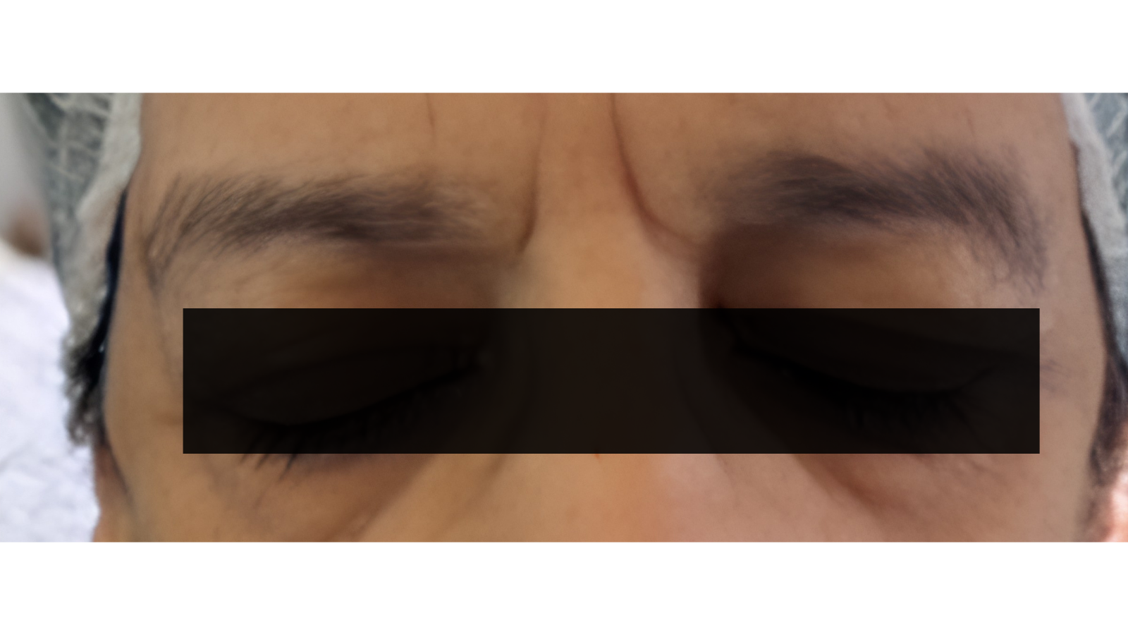 Other before
