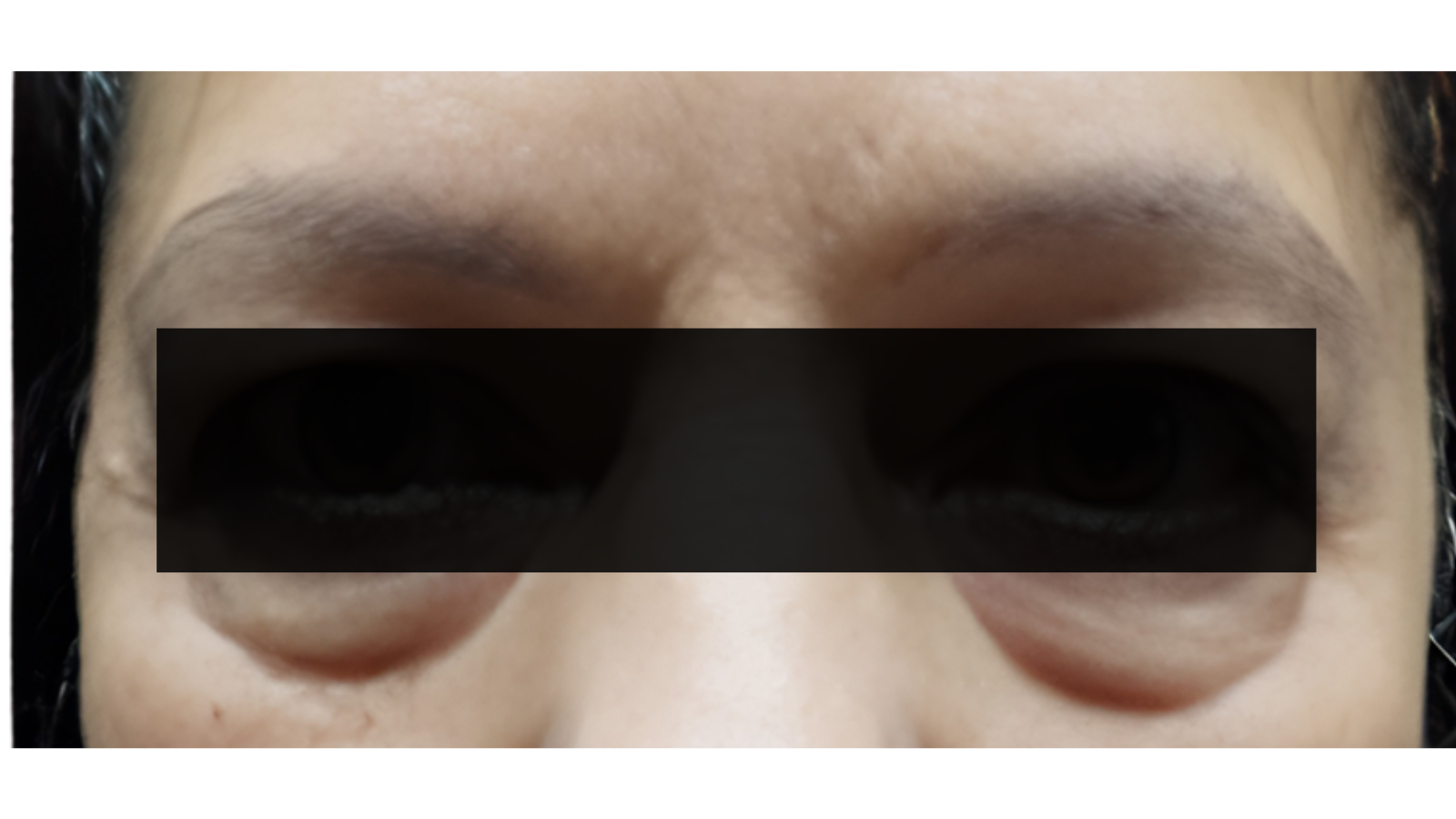 Microblading before